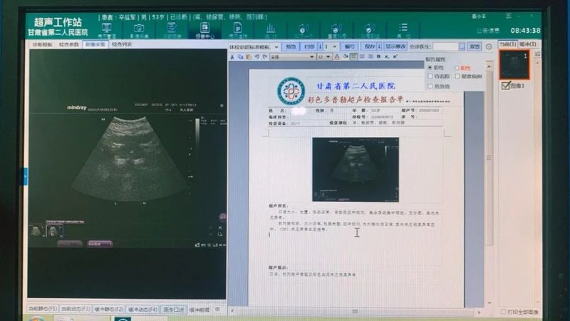 老人体检前空腹时间要求